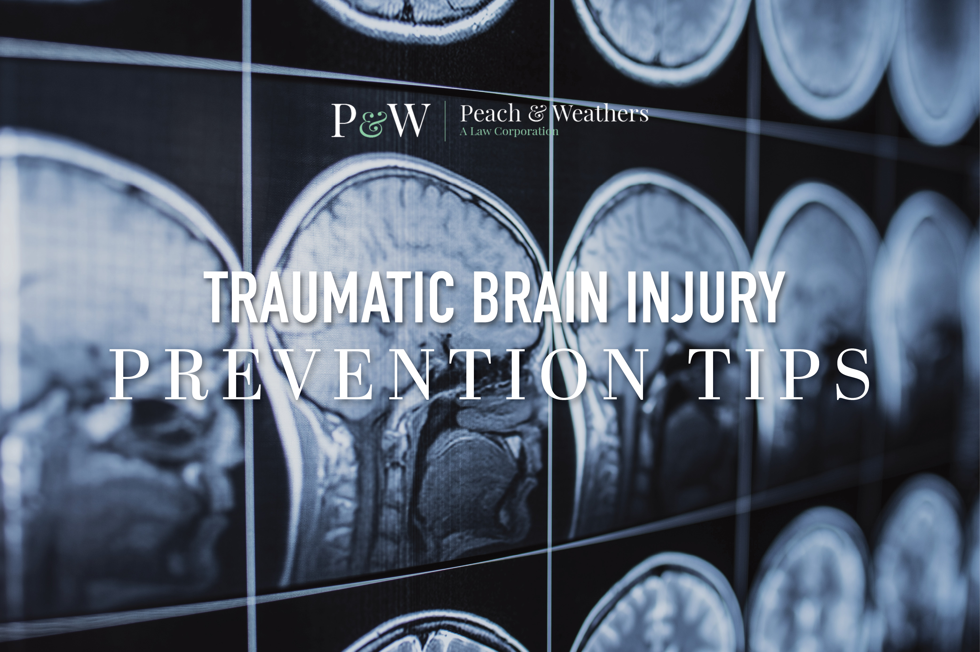Traumatic Brain Injury Prevention Tips